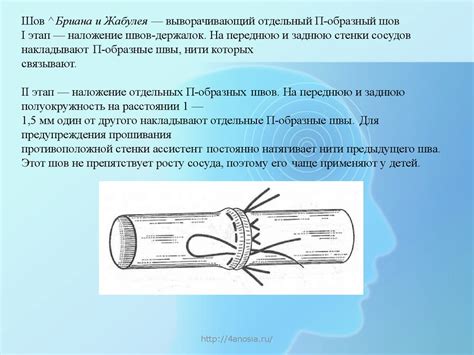 Механизмы возникновения и переживания пощечин на нервах