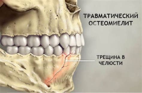 Механизмы и причины щелчка челюсти