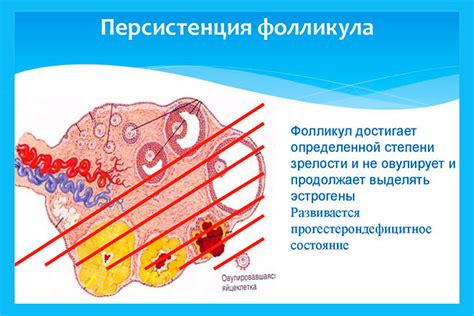 Механизмы работы персистирующего фолликула