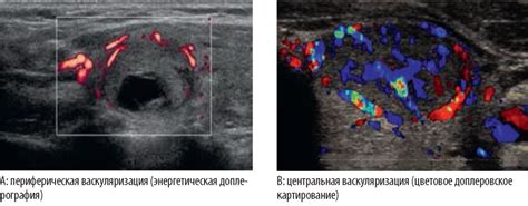 Механизмы функционирования перинодулярного кровотока