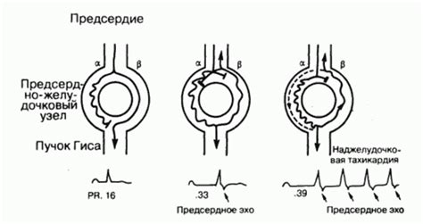 Механизм возникновения эха