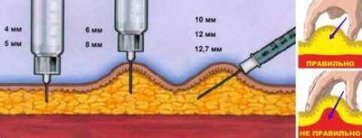 Механизм действия подкожных уколов на организм