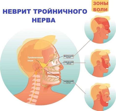 Механизм развития воспаления тройничного нерва