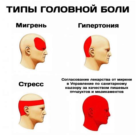 Мигрень и головные боли синусов