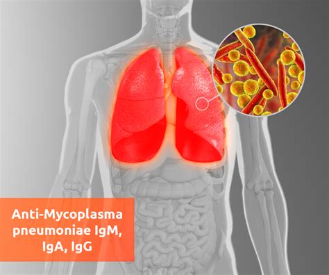 Микоплазма pneumoniae IgM положительный: