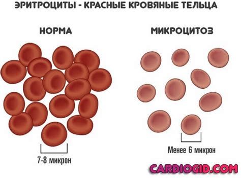 Микроцитоз слабо выражен - что это значит?