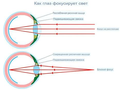 Миопия: понятие и симптомы