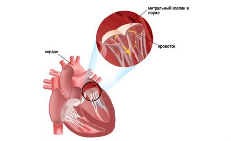 Митральный клапан: разнонаправленное движение
