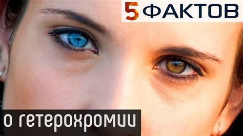 Мифы и факты о гетерохромии