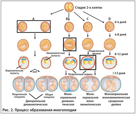 Многоплодная беременность