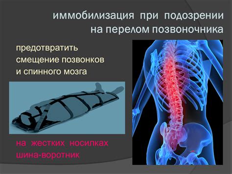 Можно ли предотвратить незначительное смещение при переломе?