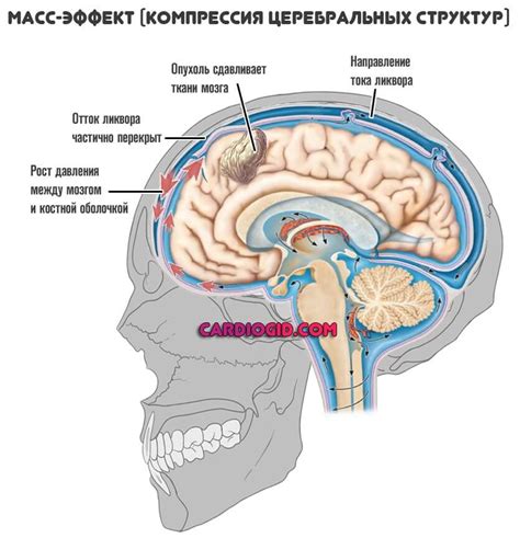 Мозг атрофировался: причины и последствия