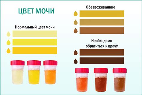 Мочеиспускательная система: что говорит анализ мочи