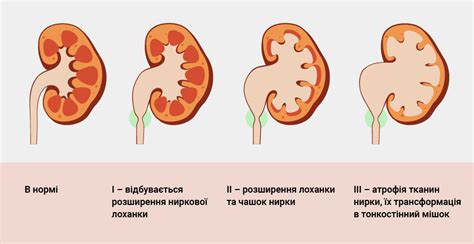 Наличие полипов или опухолей