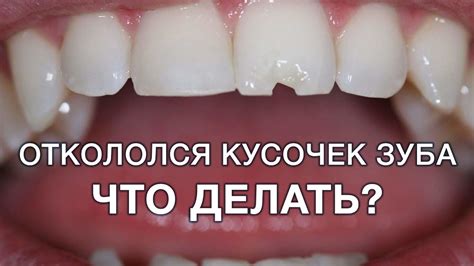 Напоминание о незавершенных делах: символическое значение безболезненного выпадения зуба без крови