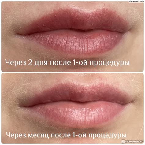 Напыление губ: все, что нужно знать