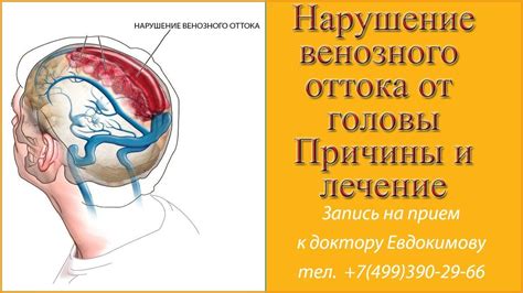 Нарушение венозного оттока головного мозга: первичная патология