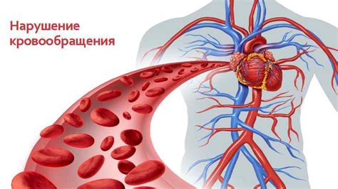 Нарушение естественного кровообращения