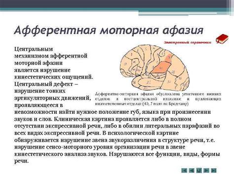 Нарушение мимики и жестов при моторной афазии