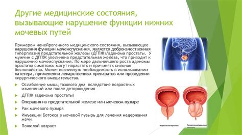 Нарушение мочеиспускания: основные факторы, вызывающие сдавление простаты