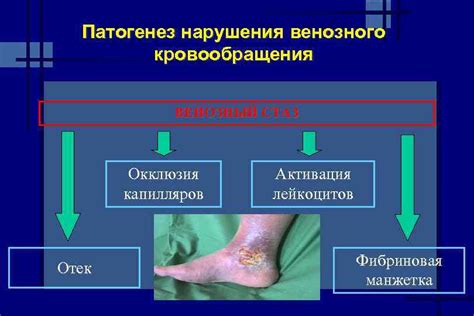 Нарушения кровообращения и повышение венозного давления