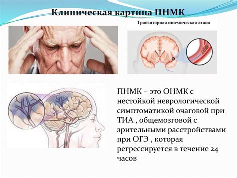 Нарушения мозгового кровообращения: важная проблема