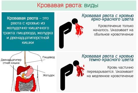 Наследственная предрасположенность к рвоте с кровью