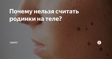 Наследственность и черные родинки