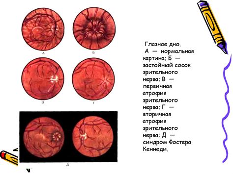 Наследственные и приобретенные факторы риска