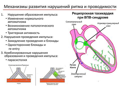 Наука и исследования: Проблема нарушения проводимости