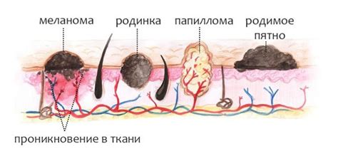 На каких основаниях делаются диагнозы наростов на голове?