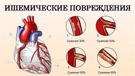 Неврогенные поражения сердца и желудка