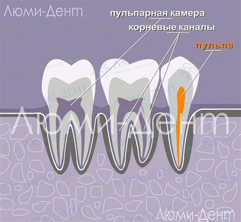 Недолеченный канал зуба: что может произойти