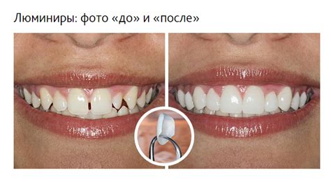 Недостатки и противопоказания