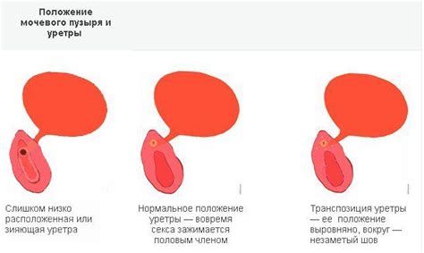 Недостаток гигиены как причина возникновения проблемы на коже задницы