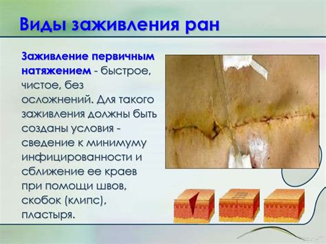 Недостаточное время высыхания клея и механические повреждения