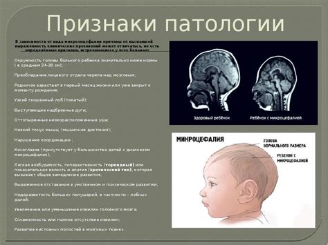 Незрелость коры головного мозга у ребенка