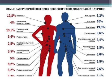 Неизлечимые заболевания сочленений