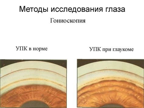 Неинвазивные методы исследования глаза: преимущества и основные методы