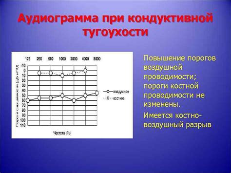 Нейросенсорная потеря слуха двусторонняя 1 степени