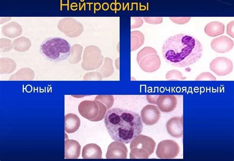 Нейтрофилы в крови – что это? Влияние на состояние организма