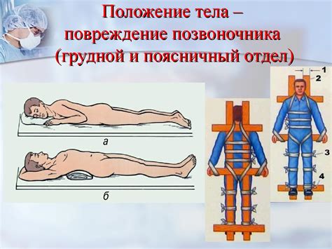 Некорректная иммобилизация