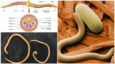Нематоды: сущность и механизм возратов к человеку