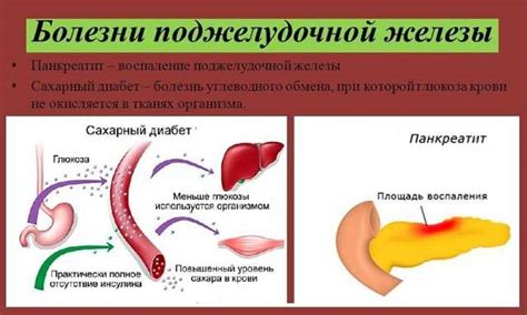 Немотивированность и диабет: взаимосвязь и решение