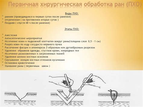 Необходимые инструменты для обработки раны