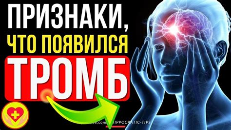 Неокклюзирующий тромбоз: симптомы, причины и методы диагностики