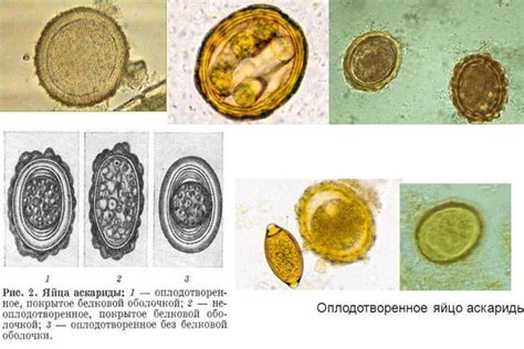 Неоплодотворенные яйца аскариды