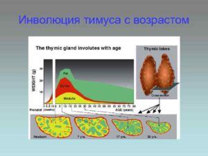 Неполная редукция тимуса: