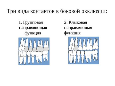 Неправильное расположение зубов и нарушение окклюзии