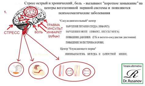 Нервное возбуждение и икота